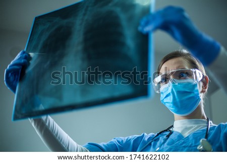 Female pulmonologist or oncologist holding chest X-ray scan,inspecting COVID-19 patient lungs,wearing PPE uniform,Coronavirus acute respiratory new virus disease infection causing breathing problems