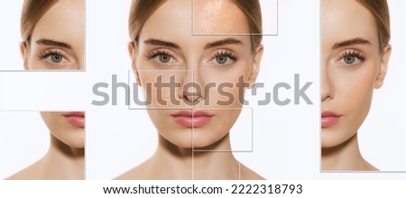 Female skin problems close-up. Beautiful brunette woman and facial diseases: acne, blackheads, dry, oily, wrinkles, dark circles. White background. Skincare, healthcare, beauty and aging process