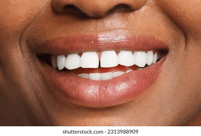 Female smile with natural white teeth closeup