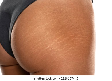 Female tanned hips with a stretch marks and cellulite on white studio background.