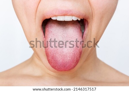 Female tongue with a white plaque. Cropped shot of a young woman showing tongue isolated on a white background. Digestive tract disease, organ dysfunction, poor oral hygiene, fungal infections