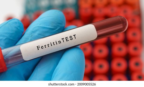 80 Serum ferritin test Images, Stock Photos & Vectors | Shutterstock