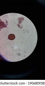 Fertile Worms Egg Ascariasis Lumbricoides