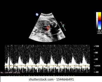 3,037 Doppler echocardiography Images, Stock Photos & Vectors ...