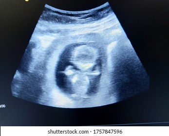 fetal face 14 weeks by ultrasound scan  - Shutterstock ID 1757847596