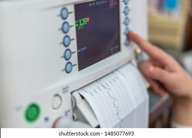 Fetal Heart Rate Monitoring In Hospital