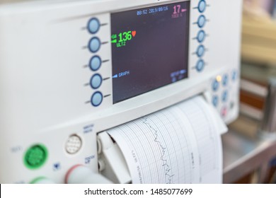 Fetal Heart Rate Monitoring In Hospital