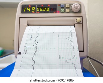 Fetal Monitor Or Non Stress Test Printing The Baby's Heart Beats Or Electrocardiograph And Mother Uterine Contraction In Delivery Or Labor Room At Hospital, Show Healthy Mother And Baby