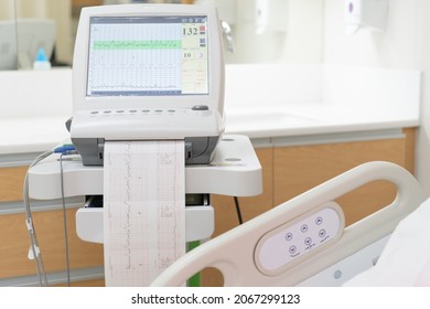 Fetal monitor with Printing of cardiogram by Electrocardiograph. Graph recording of cardiogram from Electronic fetal monitor use for heartbeat examination. Pregnancy care technology concept.