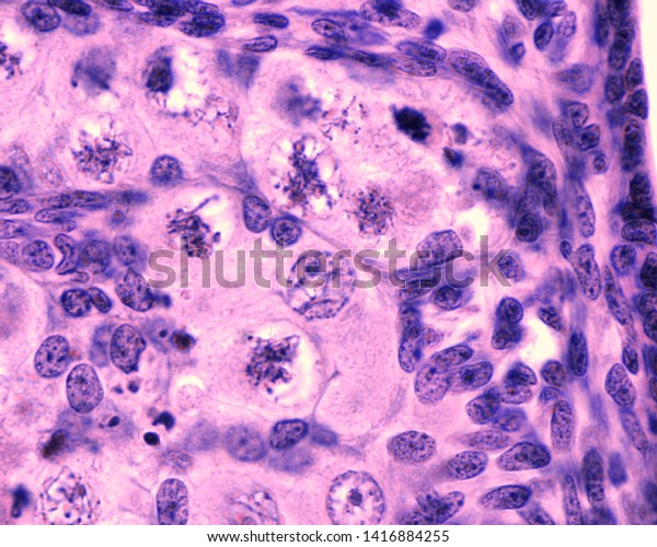 Fetal Ovary Oocyte Meiosis Micrograph Showing Stock Photo 1416884255 ...