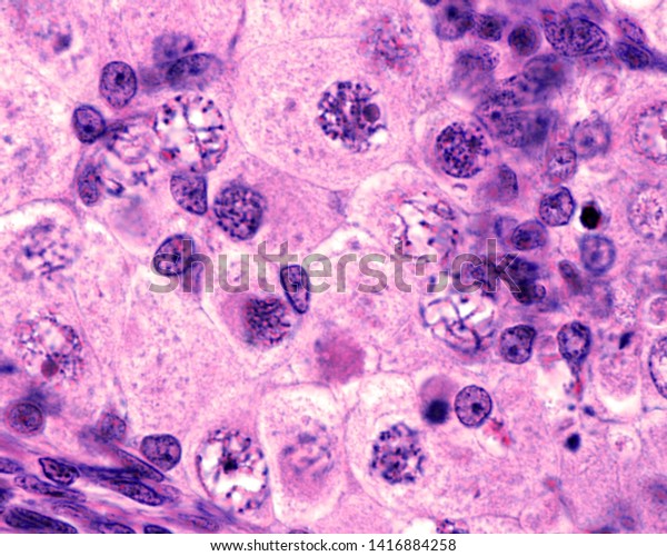 Fetal Ovary Oocyte Meiosis Micrograph Showing Stock Photo 1416884258 