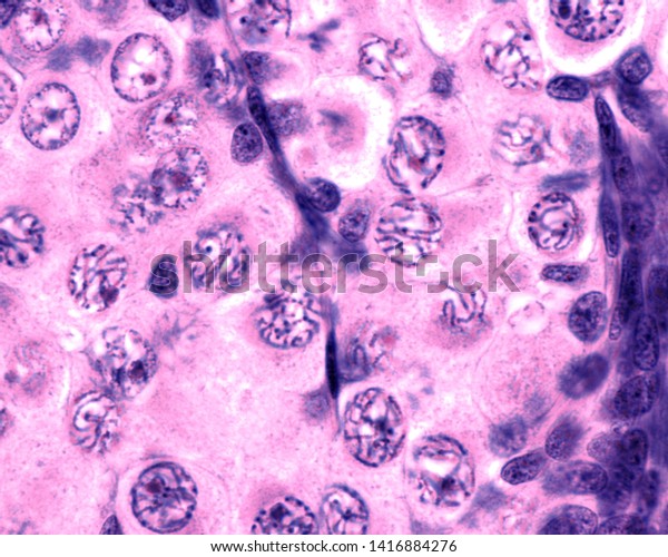 Fetal Ovary Oocyte Meiosis Micrograph Showing Stock Photo (Edit Now ...