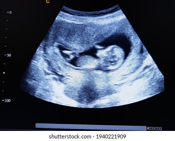 fetus 14 weeks by ultrasound scan  - Shutterstock ID 1940221909