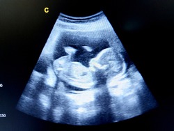 Ultrasound echo on foot | Health & Medical Stock Photos ~ Creative Market