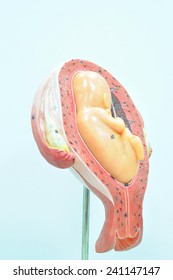 Fetus In The Fifth Month, Breech Presentation