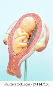 fetus in the fifth month, breech presentation
