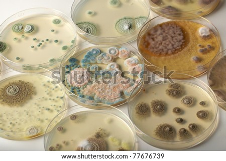 few different petri dishes with agar and bacterium colony on white table top