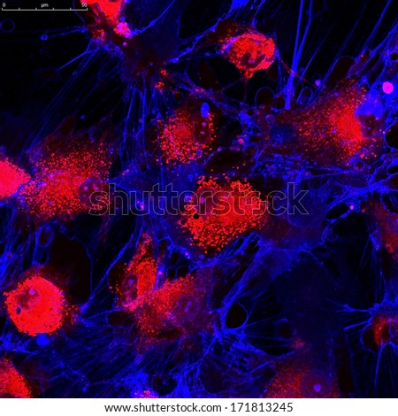 Fibroblasts (skin  cells) labeled with fluorescent dyes. Mitochondrias are in red, memrane is in blue
