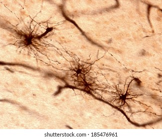 Fibrous astrocytes of brain tissue showing many long and thin processes. Golgi's silver chromate method.