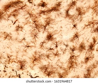 Fibrous astrocytes of white matter of cerebellar cortex showing many long and thin processes. Golgi's silver chromate method.