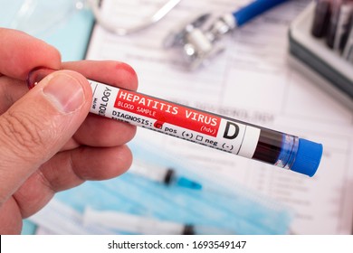 Fictional Blood Samples With Infected Hepatitis D Virus, With Stethoscope, Mask And Syringe And Other Stuff.