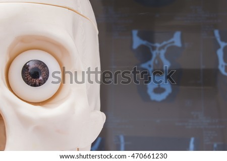 The figure of human skull with eye socket and eye in it on background of spiral computer tomography (SCT) or magnetic resonance tomography (MRT) picture close up. Idea for diagnostics in ophthalmology