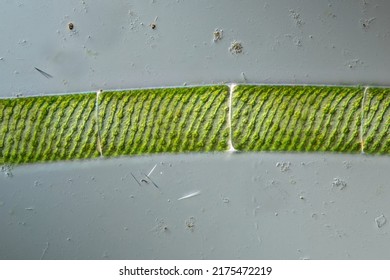 filamental green screw algae in the pond