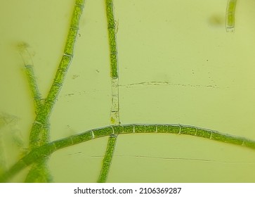 Filamentous Algae Under Transmissive Light Microscope Stock Photo (Edit ...