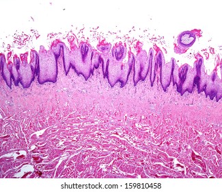 115 Filiform papillae Images, Stock Photos & Vectors | Shutterstock