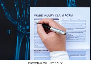 filling up a work injury claim form with a wrapped hand on top of an X-ray film medical and insurance concept
