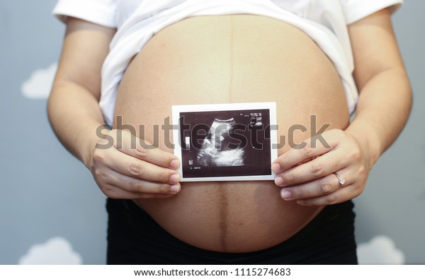 x ray of pregnant woman's abdomen