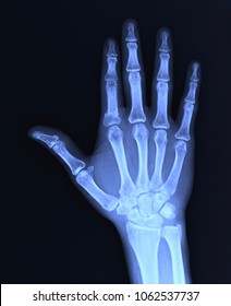 21,926 Hand x ray Stock Photos, Images & Photography | Shutterstock