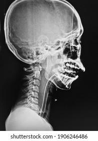 Film x-ray of  human skull on isolated
