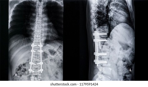 206 Film l s spine Images, Stock Photos & Vectors | Shutterstock