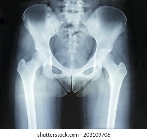 Perineum Images, Stock Photos & Vectors | Shutterstock