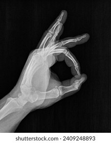 Radiografía de rayos X o radiografía de un círculo de pulgar y dedo asociado con ok, acuerdo, aprobación, confirmación o positividad en lenguaje gestural, comunicación manual o firma en lenguaje de señas