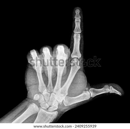 Film xray x-ray or radiograph of a thumb and finger in gestural language, manual communication, or signing aka sign language, pointing up this way or that way