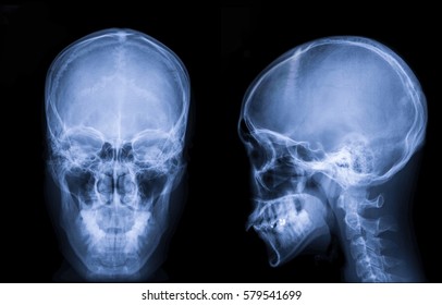 Face Xray Images Stock Photos Vectors Shutterstock