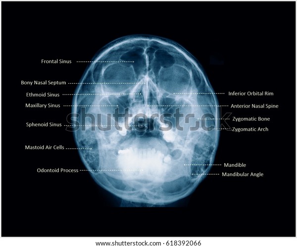 Film Xray Skull Water View Facial 庫存照片 立刻編輯 618392066