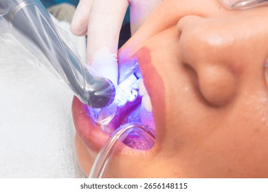 Final polymerization phase of dental composite using curing light on a lower premolar to harden the restoration material securely.