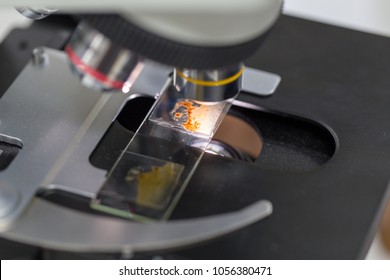 Finding parasites in feces in laboratory.