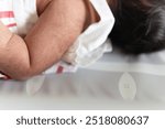 A fine, soft hair called lanugo covers the arm of the newborn, a Latina girl born with a lot of hair on her head at one week of age. Werewolf syndrome hypertrichosis.