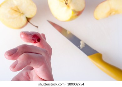 Finger cut during food preparation