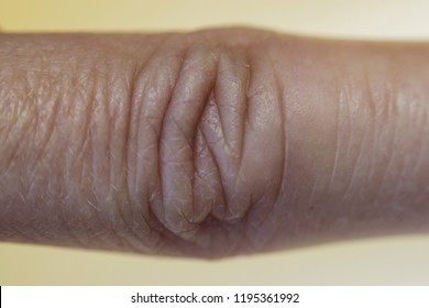 The Finger Joint Of The Female With Skin Folds, Macro Photo.