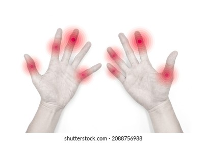 Finger Joints Inflammation. Concept And Idea Of Rheumatic Arthritis, Imgrating Polyarthritis Or Arthralgia.