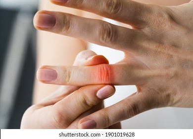 Finger Knuckle Hand Joint Pain And Sprain