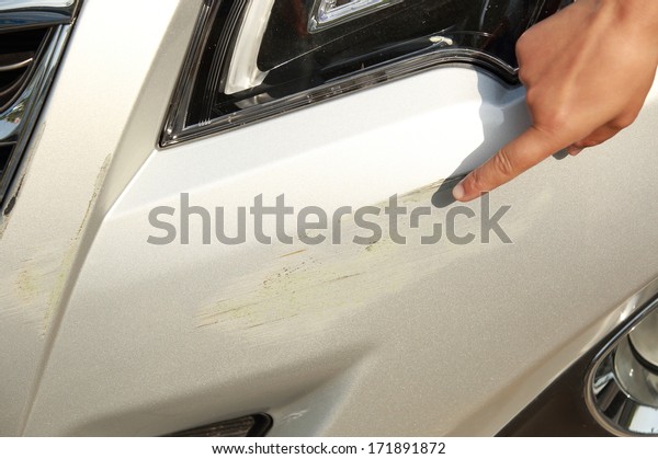 finger point at scratches on front bumper after\
accident of a car
