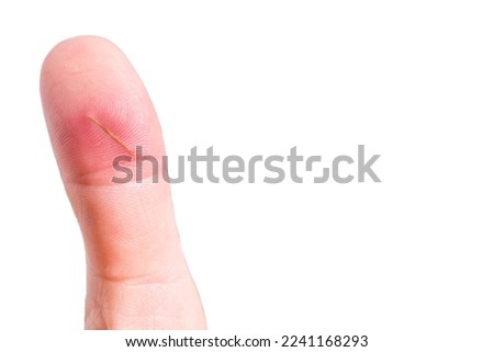 finger with splinter, infection, finger injury, copy space