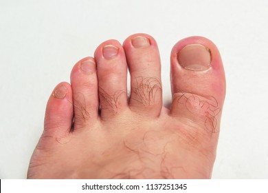 Nasty Foot