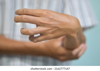 Fingers Rigidity, Hand Muscles Spasm, Or Weakness Of Digits. Closeup View.